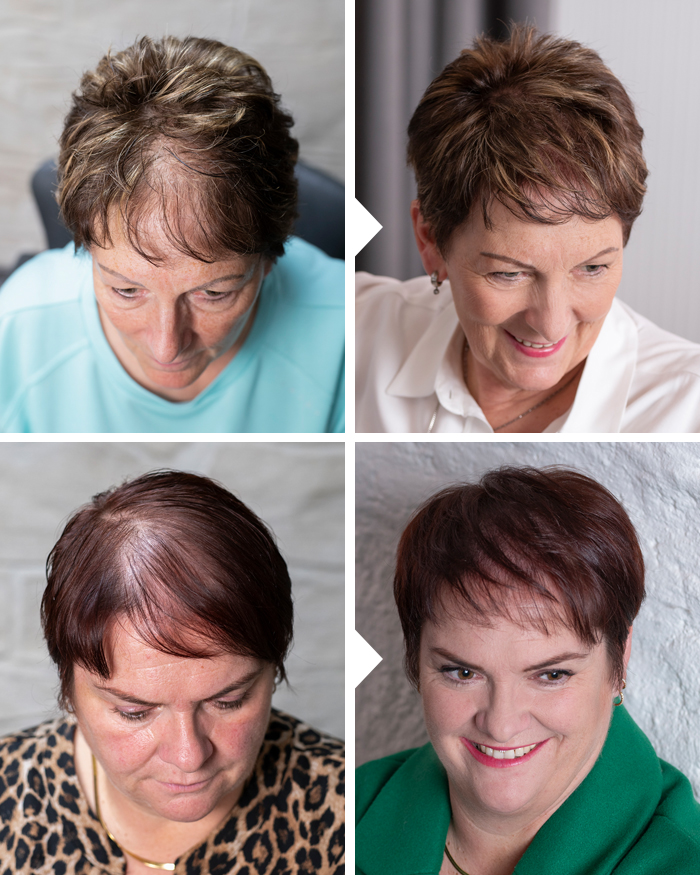 Moderne Haarverdichtung für Friseure – HeadSkin Coloring